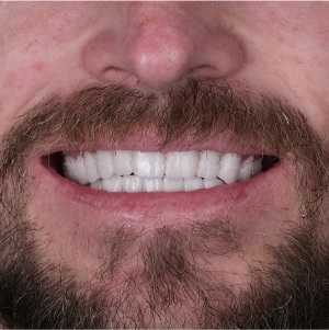 E-diş esenler,     Diş Tedavisi,Diş Estetiği,Diş Beyazlatma,     Ağız ve Diş Sağlığı,     Diş İmplantı,     Porselen Lamina,     Diş Protezi,     Çocuk Diş Hekimi,     Diş Ağrısı Tedavisi,     Gülüş Tasarımı,     Diş Temizliği,     Periodontal Tedavi,     Diş Eti Hastalıkları,     Diş Fırçalama Teknikleri,     Köprü Protez Tedavisi,     Kanal Tedavisi,     Diş Hekimi Randevusu,     Diş Beyazlatma Fiyatları,     Ağız Kokusu Nedenleri,     Diş Çürümesi Tedavisi,     Diş Hekimi İstanbul,     Diş Hekimi Danışmanlığı,     Ağız Hijyeni Önerileri